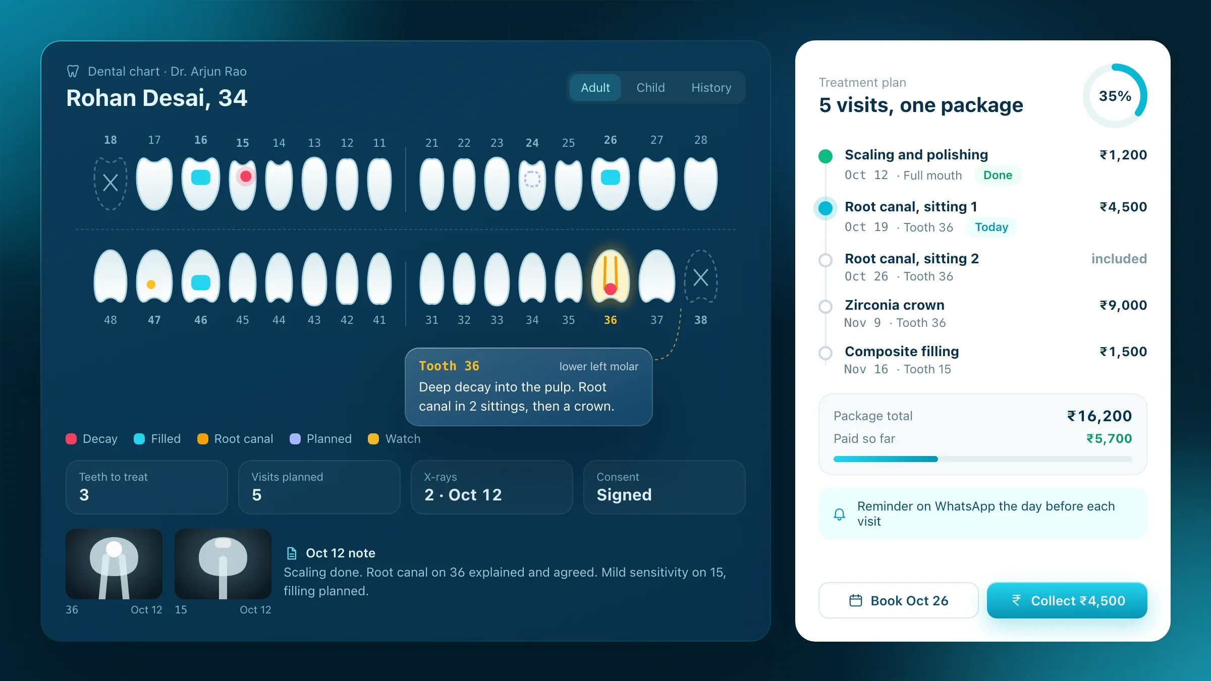 A dental chart with a treatment plan across visits